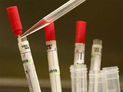 基因检测：：：理想丰满 现实骨感